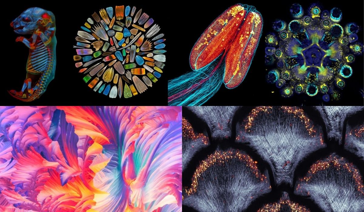 Premio Olympus 2020: Las mejores imágenes tomadas por microscopio