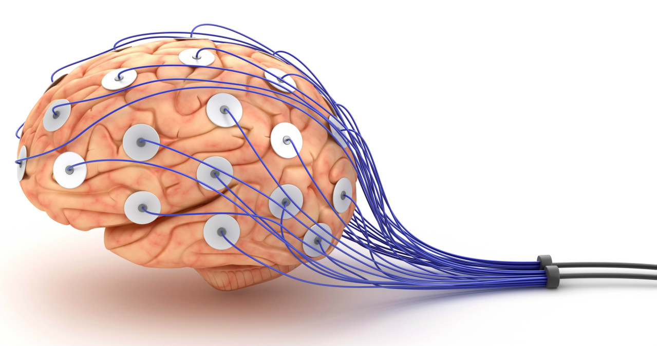 Qué revelaron los estados neuronales del cerebro de una persona antes de morir